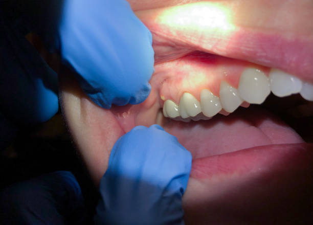 Best Emergency Root Canal Treatment in Montgomery, WV