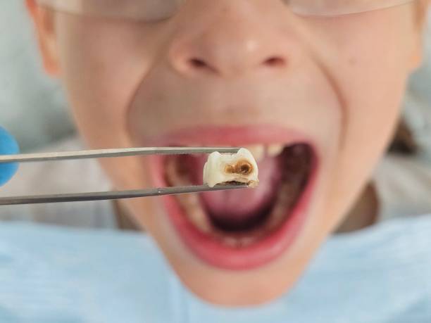 Best Emergency Denture Repair in Montgomery, WV